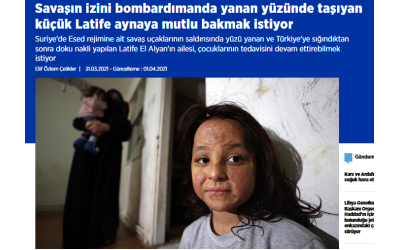 Savaşın izini bombardımanda yanan yüzünde taşıyan küçük Latife aynaya mutlu bakmak istiyor